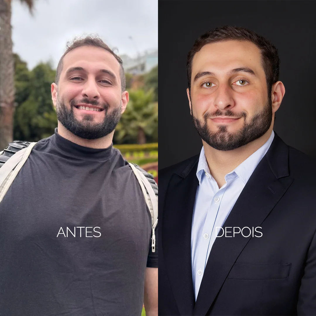 Transformação de imagem profissional - cliente 4